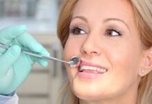 ضحية إهمال طبيب أسنان في الزقازيق يستغيث بوزارة الصحة